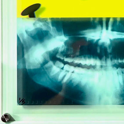 Killer Smile X-Ray medium